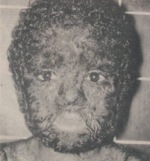 lobiso.jpg